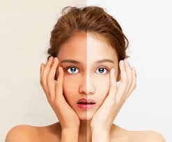 Beyond Whitening: Synlotic Biotechs vitenskapelige tilnærming til lysere, jevnere hud